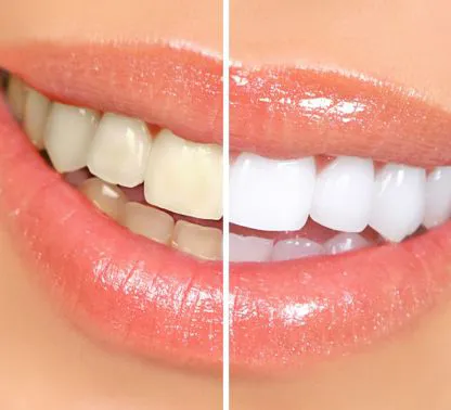 Servizio di odontoiatria estetica