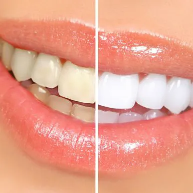 Servizio di odontoiatria estetica