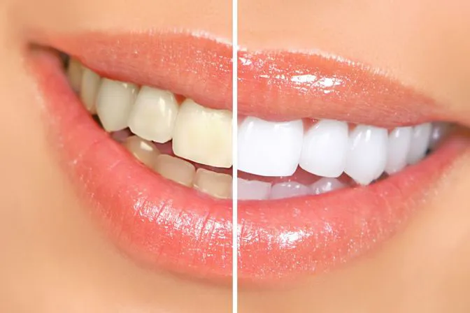 Servizio di odontoiatria estetica