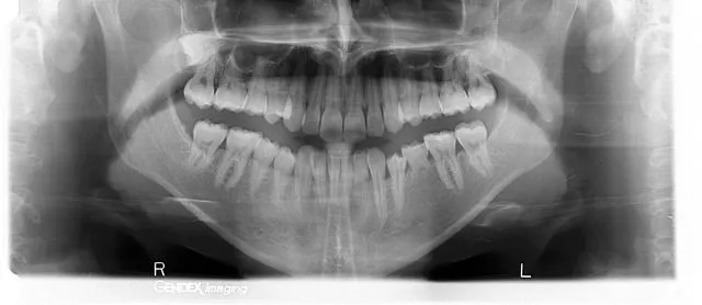 Servizio di Radiografia e panoramica dentale