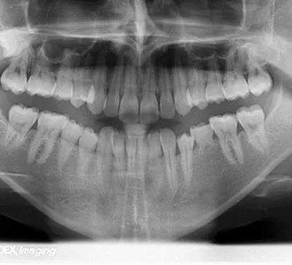 Servizio di Radiografia e  panoramica dentale