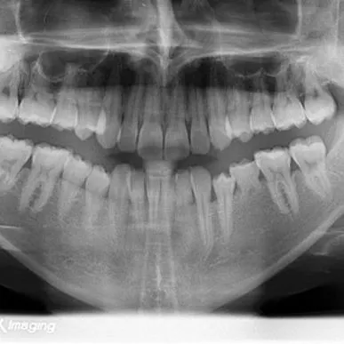 Servizio di Radiografia e  panoramica dentale