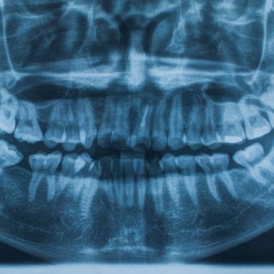 Servizio di Radiografia e  panoramica dentale